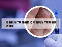 可善挺治疗银屑病日记 可善挺治疗银屑病用法用量