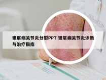 银屑病关节炎分型PPT 银屑病关节炎诊断与治疗指南