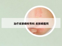 治疗皮肤癣科专科 皮肤癣医院