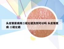 头皮银屑病用二硫化硒洗剂可以吗 头皮银屑病 二硫化硒