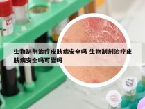 生物制剂治疗皮肤病安全吗 生物制剂治疗皮肤病安全吗可靠吗