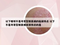 以下哪项不是寻常型银屑病的临床特点 以下不是寻常型银屑病皮损特点的是