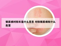 银屑病对称长是什么意思 对称银屑病有什么危害