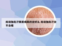 练瑜伽出汗银屑病真的会好么 练瑜伽出汗会不会瘦