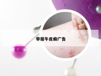 举报牛皮癣广告