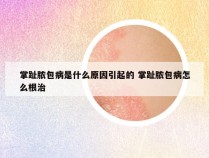 掌趾脓包病是什么原因引起的 掌趾脓包病怎么根治
