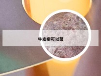 牛皮癣可以菜