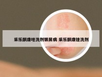采乐酮康唑洗剂银屑病 采乐酮康锉洗剂