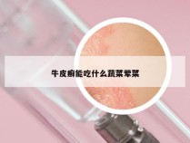 牛皮癣能吃什么蔬菜荤菜
