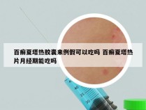 百癣夏塔热胶囊来例假可以吃吗 百癣夏塔热片月经期能吃吗