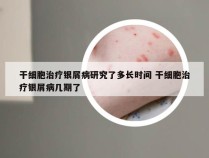 干细胞治疗银屑病研究了多长时间 干细胞治疗银屑病几期了