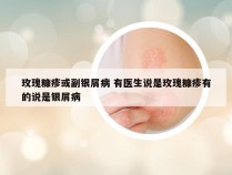 玫瑰糠疹或副银屑病 有医生说是玫瑰糠疹有的说是银屑病