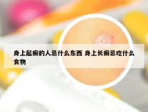 身上起癣的人忌什么东西 身上长癣忌吃什么食物