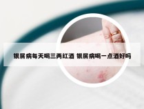 银屑病每天喝三两红酒 银屑病喝一点酒好吗