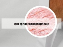 哪些是白癜风疾病早期的症状