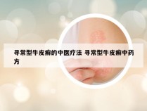 寻常型牛皮癣的中医疗法 寻常型牛皮癣中药方