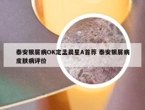 泰安银屑病OK定孟晨星A首荐 泰安银屑病皮肤病评价