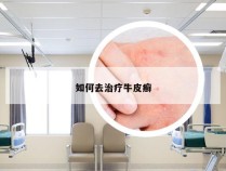 如何去治疗牛皮癣