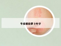 牛皮癣白萝卜叶子