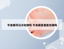 牛皮癣可以少吃辣吗 牛皮癣患者能吃辣吗