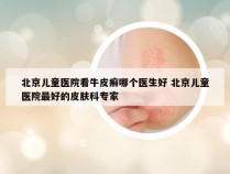 北京儿童医院看牛皮癣哪个医生好 北京儿童医院最好的皮肤科专家