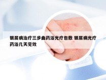 银屑病治疗三步曲药浴光疗包敷 银屑病光疗药浴几天见效