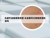 头部牛皮癣用地奈德 头皮癣可以用地奈德乳膏吗