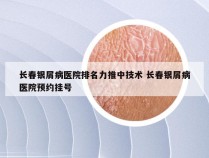 长春银屑病医院排名力推中技术 长春银屑病医院预约挂号