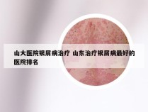 山大医院银屑病治疗 山东治疗银屑病最好的医院排名