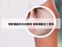 银屑病能吃大白菜吗 银屑病能吃韮菜吗