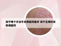 南宁哪个诊治牛皮癣医院最好 南宁正规的皮肤病医院
