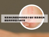 银屑病吃胸腺肽和转移因子谁好 银屑病吃胸腺肽和转移因子谁好些