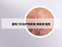 医院门诊治疗银屑病 银屑病 医院