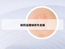 如何治理城市牛皮癣