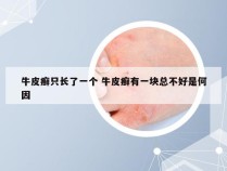 牛皮癣只长了一个 牛皮癣有一块总不好是何因