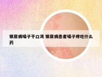 银屑病嗓子干口渴 银屑病患者嗓子疼吃什么药
