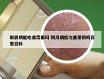 银屑病能吃韭菜根吗 银屑病能吃韭菜根吗百度百科