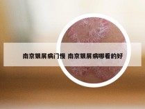 南京银屑病门慢 南京银屑病哪看的好