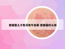 曾国藩儿子有没有牛皮癣 曾国藩的小孩