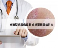 点滴型银屑病轻重 点滴型银屑病扩大