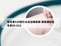 维生素b1h和什么吃治银屑病 银屑病吃维生素b6 b12
