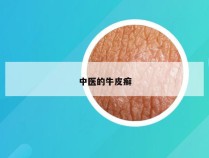 中医的牛皮癣
