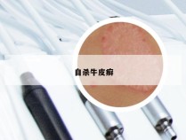 自杀牛皮癣