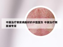 中国治疗银屑病最好的中医医生 中国治疗银屑病专家