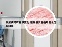 银屑病只有指甲变化 银屑病只有指甲变化怎么回事