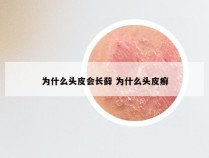 为什么头皮会长藓 为什么头皮癣