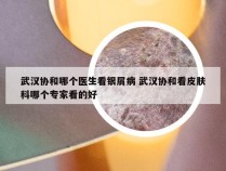 武汉协和哪个医生看银屑病 武汉协和看皮肤科哪个专家看的好
