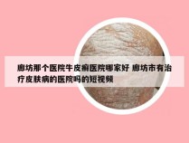 廊坊那个医院牛皮癣医院哪家好 廊坊市有治疗皮肤病的医院吗的短视频