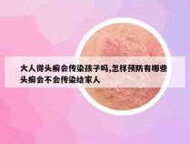 大人得头癣会传染孩子吗,怎样预防有哪些 头癣会不会传染给家人