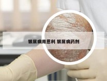 银屑病用恩利 银屑病药剂